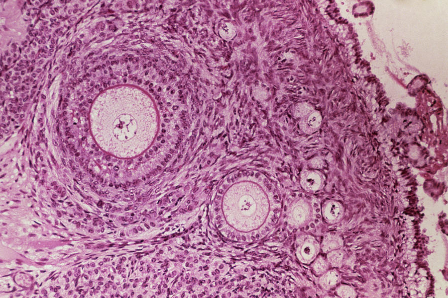 This Image Shows The Histology Of Ovarian Follicles Examples Of ...