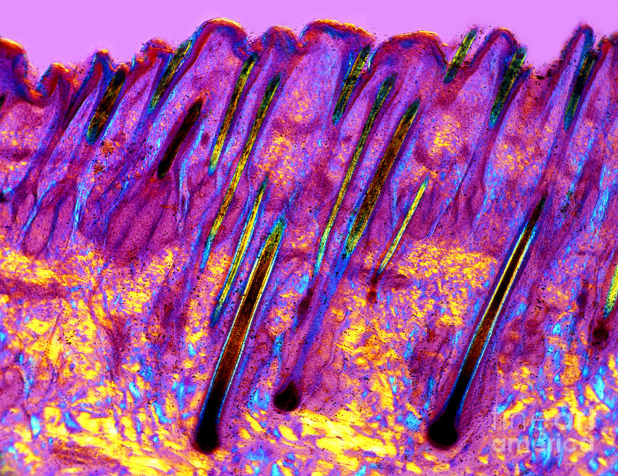 LM of Skin and Hair Follicles  Photograph by Spl