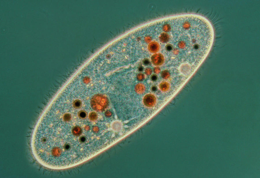 paramecium vs euglena under microscope