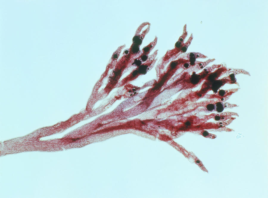 Lm Of The Red Algae Photograph by Alfred Pasieka/science Photo Library