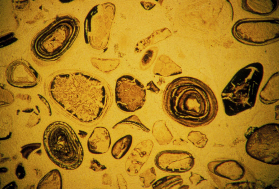 Lm Of Thin Rock Section Of Gunflint Cherts Photograph by Sinclair Stammers/science Photo Library.