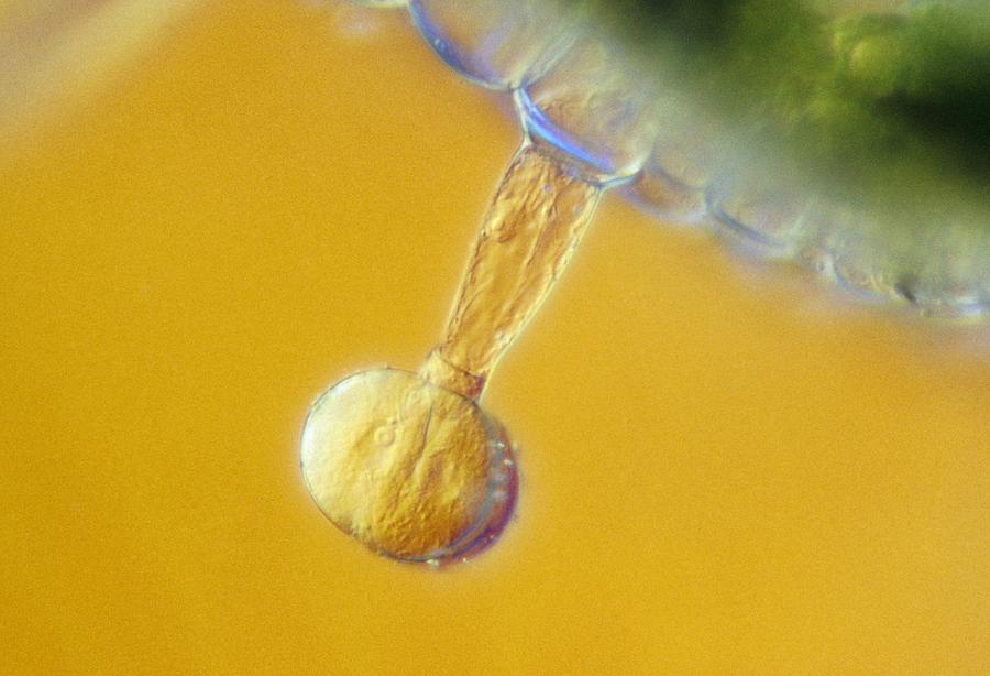 Tomato Photograph - Lm Of Tomato Trichomes by Power And Syred
