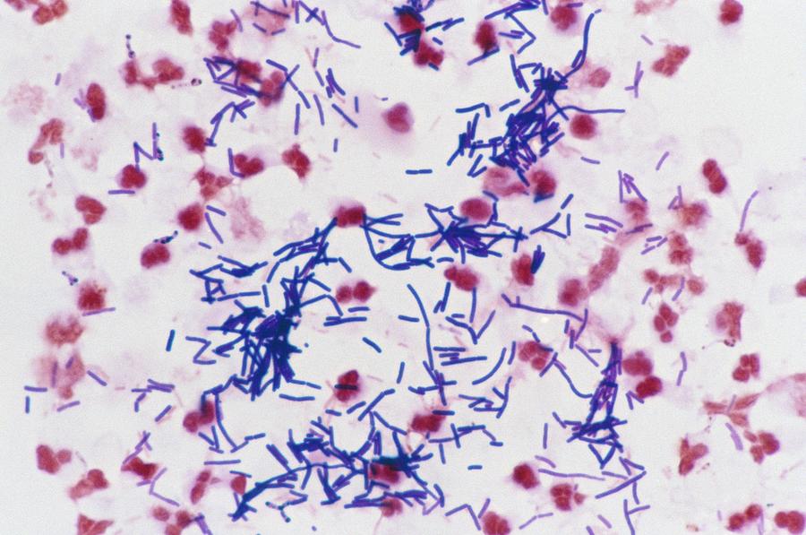 Lactobacillus Acidophilus Gram Stain