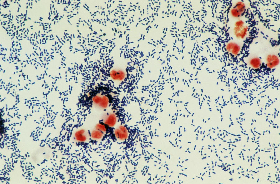 Lm Streptococcus Pneumoniae Photograph By John Durhamscience Photo Library