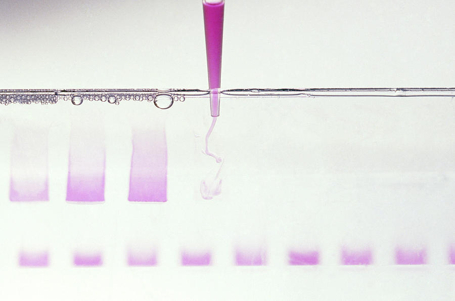 Loading A Gel With Genes Prior To Electrophoresis Photograph by Klaus Guldbrandsen/science Photo Library