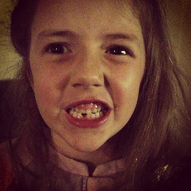 Look Who Lost Her First Tooth! Photograph by Sarah Clarke