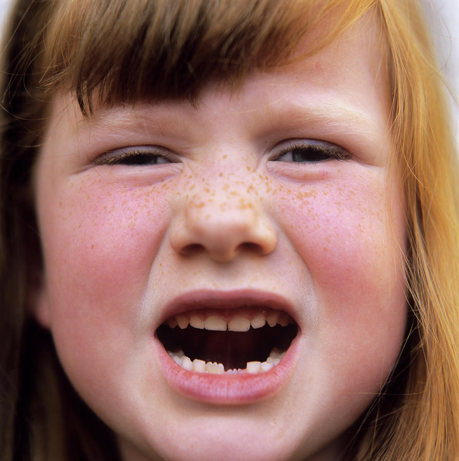 Loss Of Milk Teeth Photograph by Mark Thomas/science Photo Library