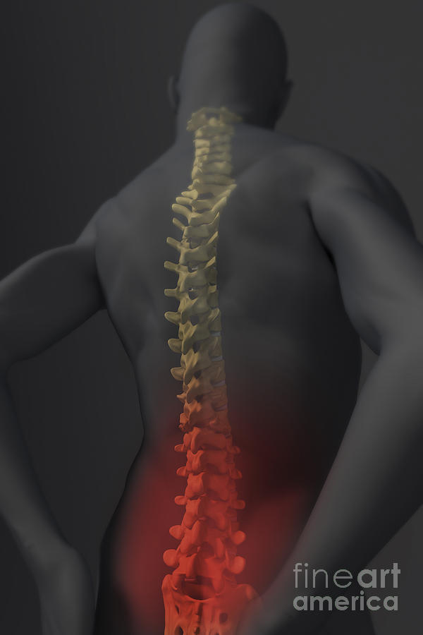 Lower Back Pain Photograph by Science Picture Co