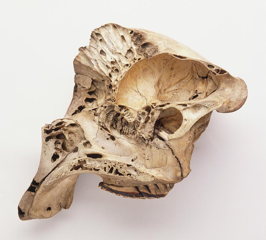 Loxodonta Africana African Elephant Skull Photograph by Dorling Kindersley/uig