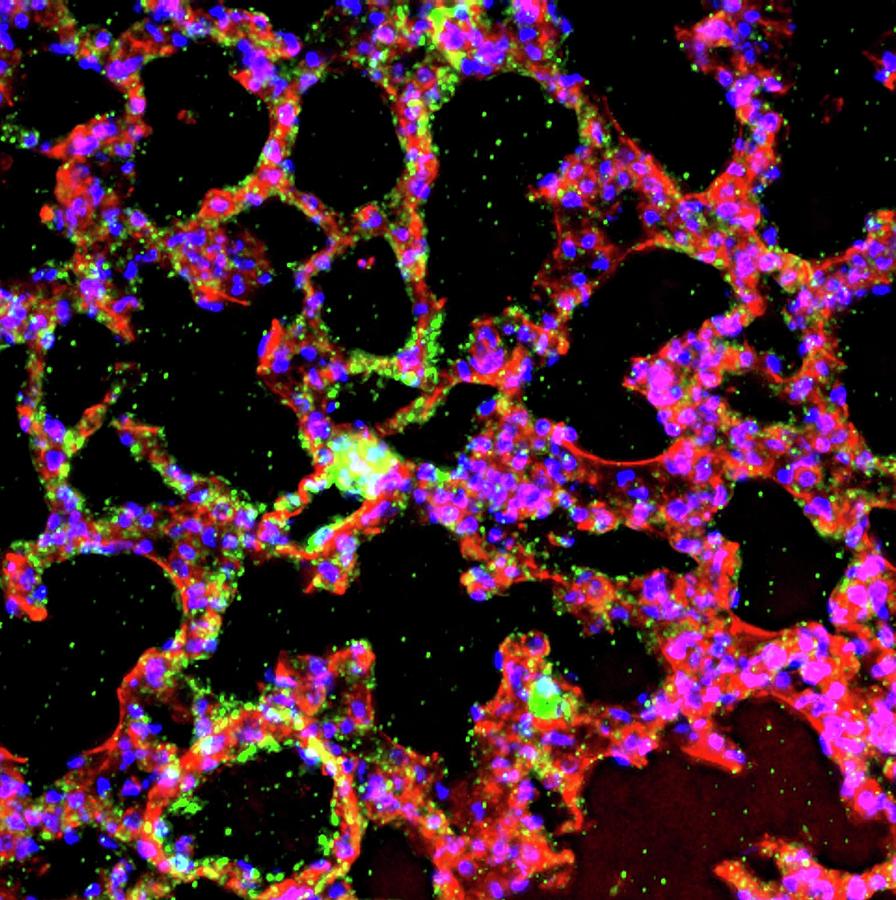 Lung Alveoli Photograph by R. Bick, B. Poindexter, Ut Medical School ...