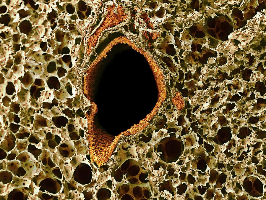 Lung Tissue Photograph by Microscopy Core Facility, Vib Gent