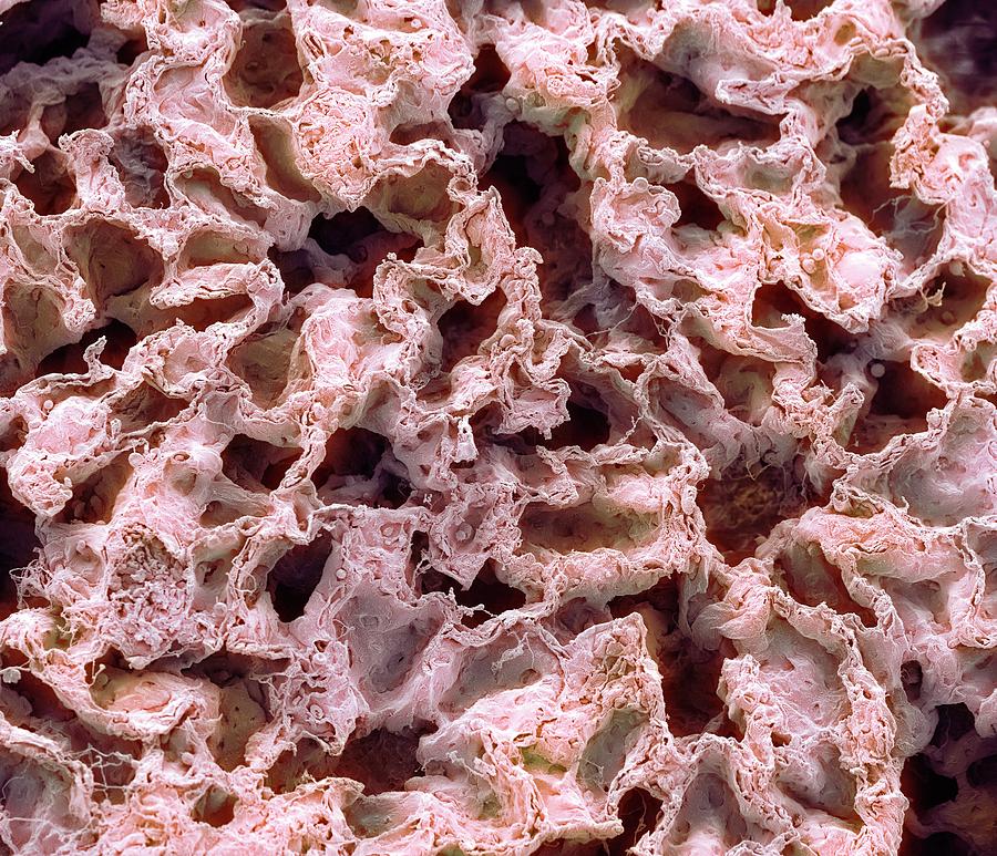 Lung Tissue Photograph by Steve Gschmeissner/science Photo Library