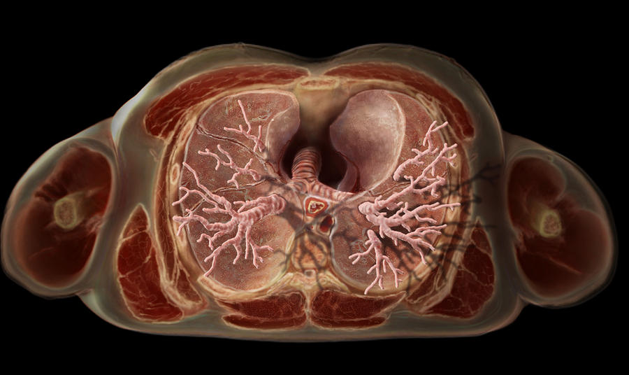 Lungs Photograph by Anatomical Travelogue