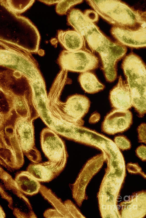 Lyme Disease Bacteria Photograph by David M. Phillips