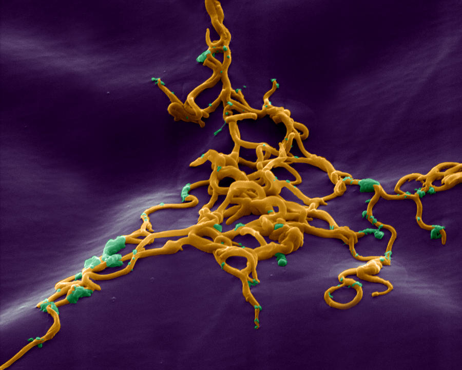 Lyme Disease Bacteria Photograph by Eye of Science