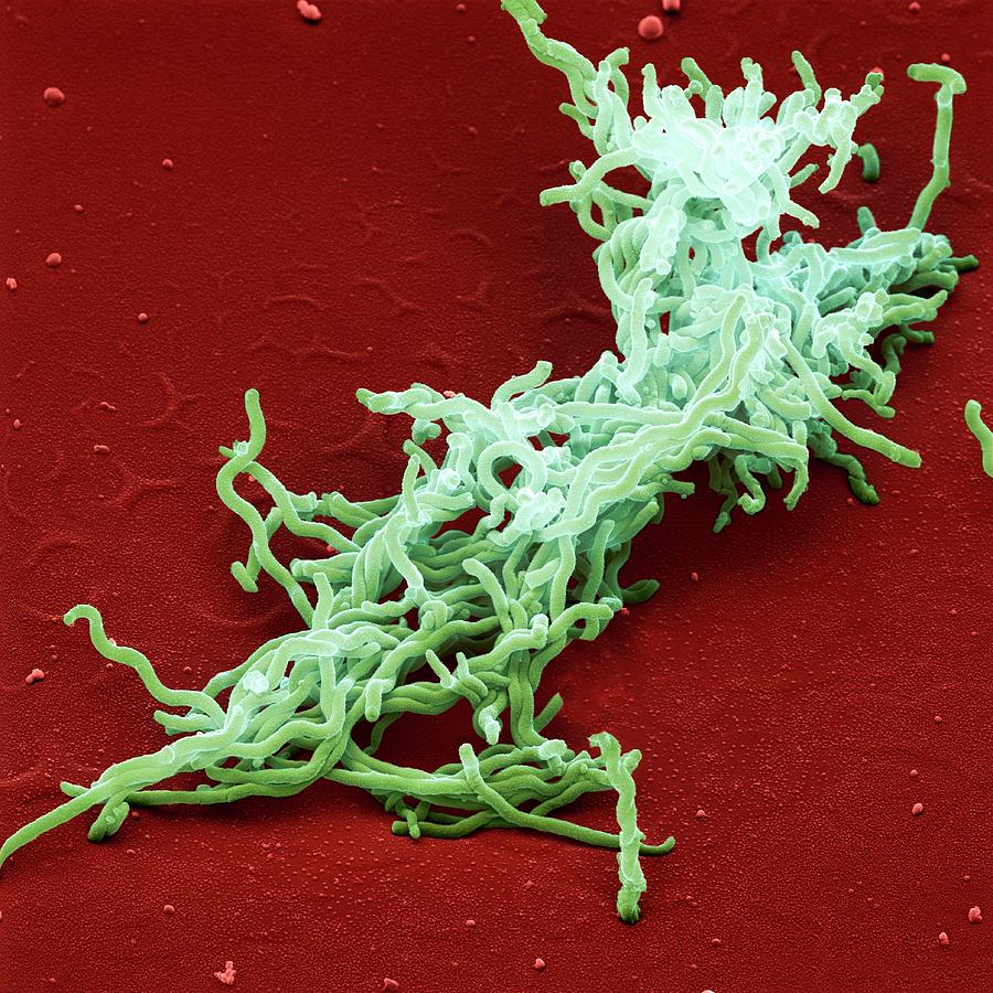 Lyme Disease Bacteria Photograph by Juergen Berger/science Photo Library