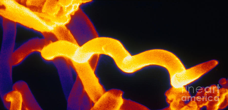 Lyme Disease Bacteria Photograph by Scott Camazine