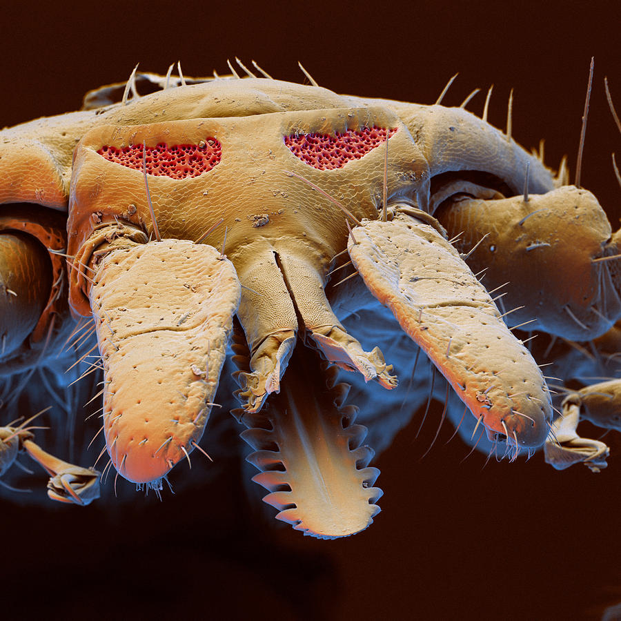 Lyme Disease Tick Mouthparts Photograph by Eye of Science