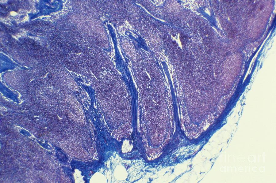 Lymph Node, Light Micrograph Photograph by Cnri - Fine Art America