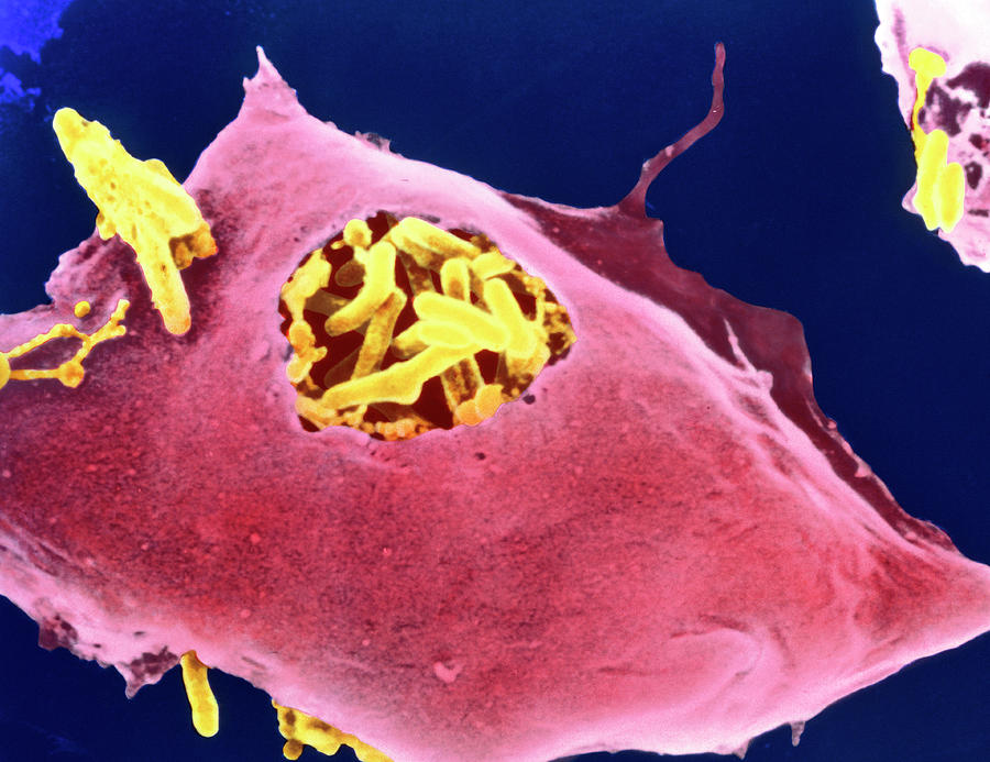 Macrophage Eating Tuberculosis Bacteria Photograph by Prof. S.h.e. Kaufmann & Dr J.r Golecki/ Science Photo Library