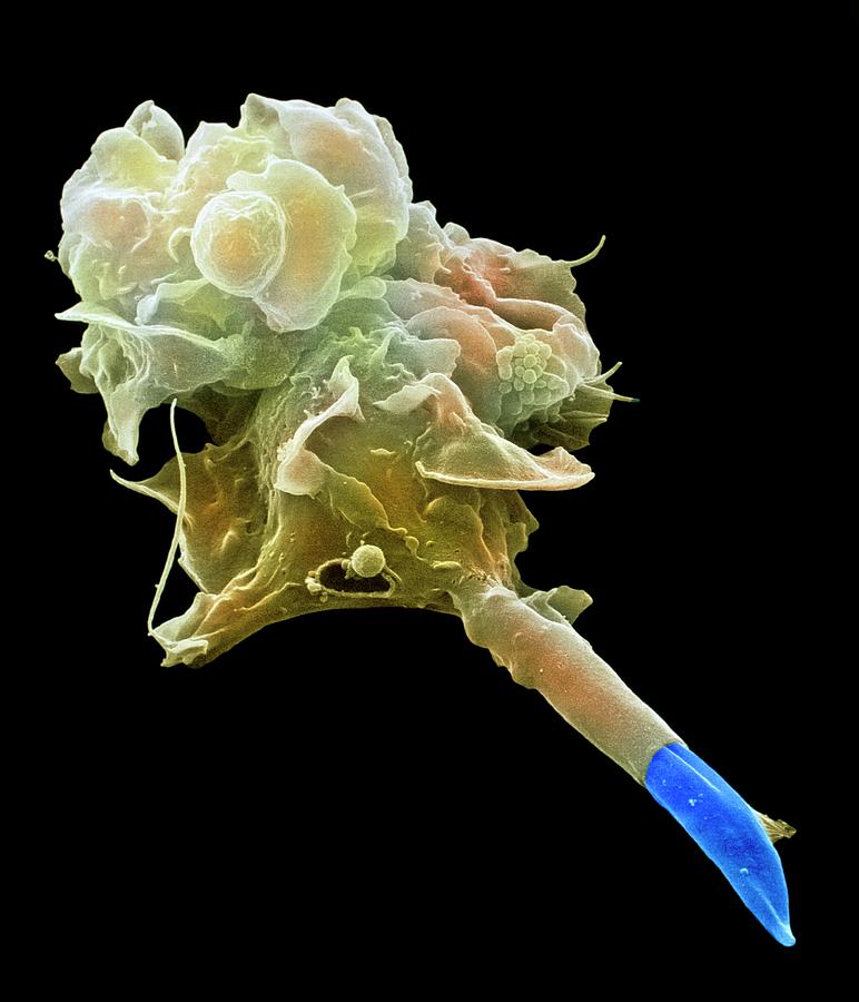 Macrophage Engulfing Leishmania Photograph by Juergen Berger/science Photo Library
