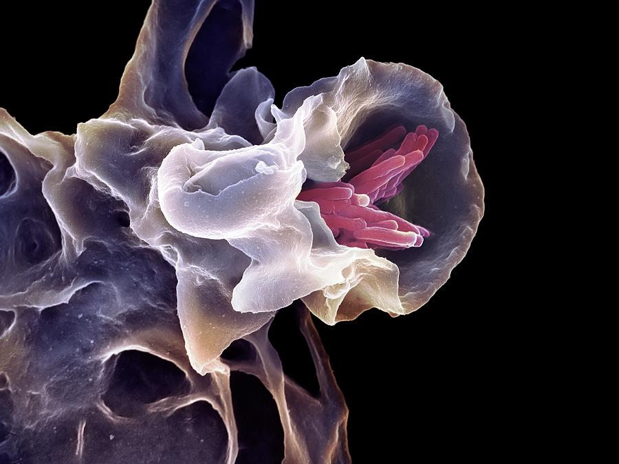 Macrophage Engulfing Tb Bacteria Photograph by 