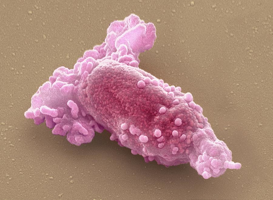 Macrophage Photograph by Steve Gschmeissner