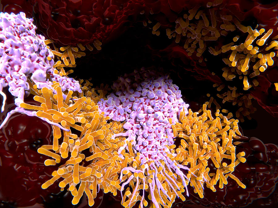 Macrophages Engulfing Tuberculosis Photograph by Juan Gaertner