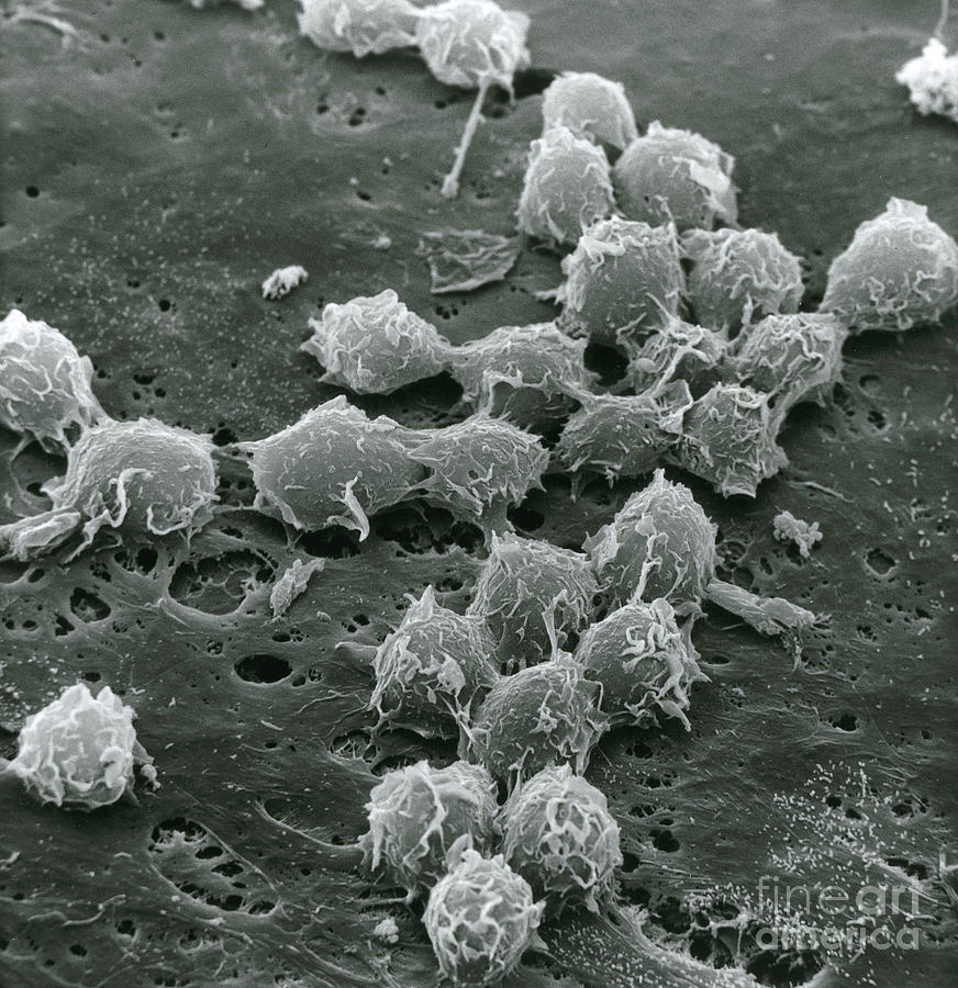 Macrophages On Endothelium Photograph by David M. Phillips