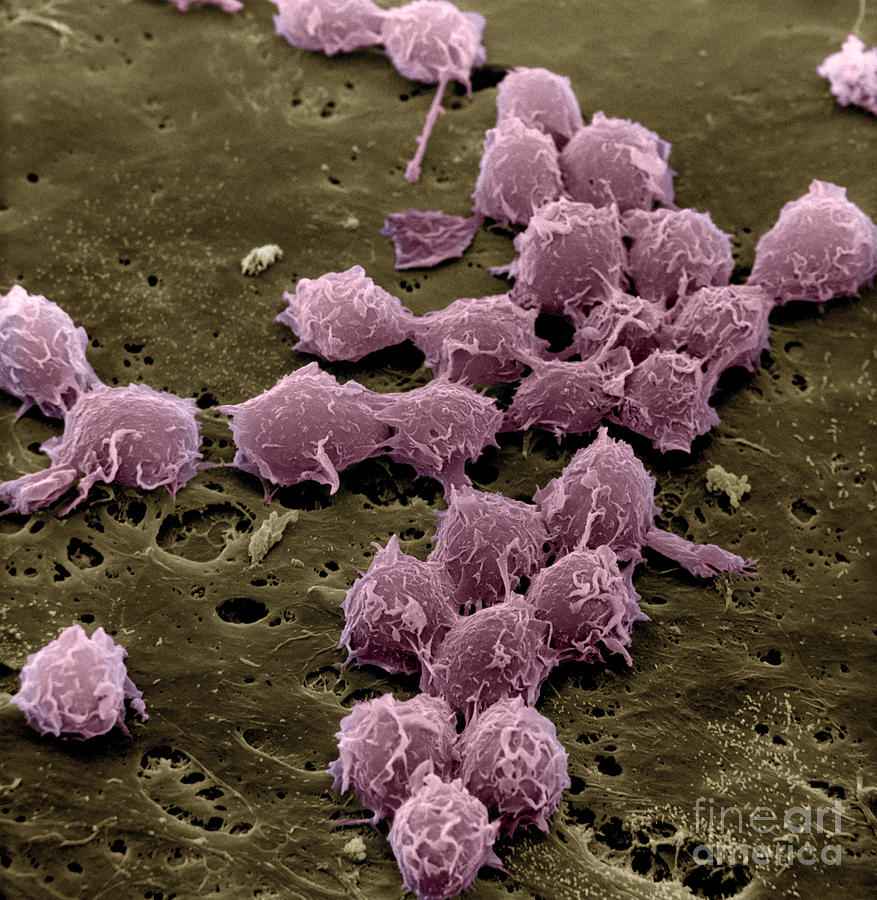Macrophages On The Surface Photograph by David M. Phillips