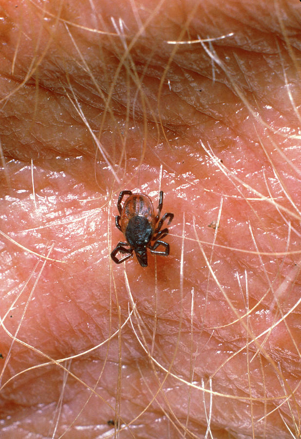 Macrophoto Of Lyme Disease Tick Nymph Photograph By Dr Jeremy Burgess