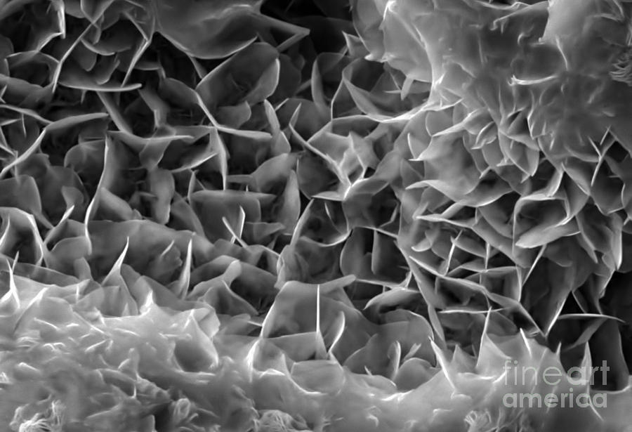 Magnesium Hydroxide In Concrete, Sem Photograph by Patrick Landmann ...