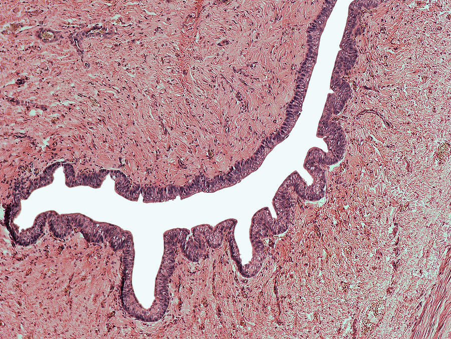 Magnified Human Female Urethra, Lm Photograph by Science Stock Photography