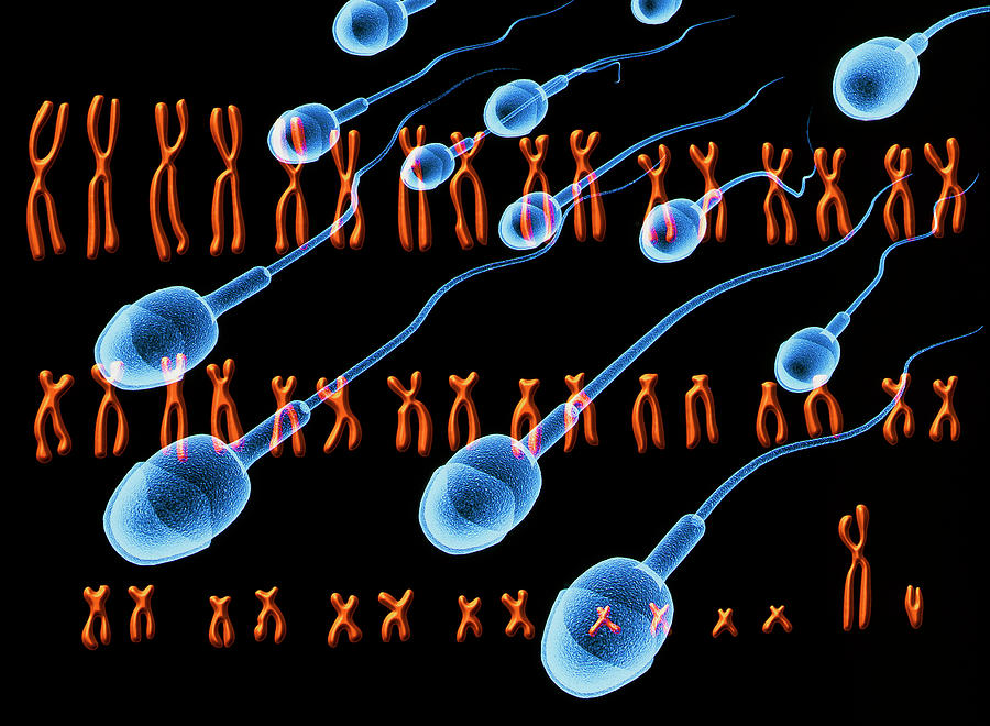 23 хромосомы у человека в клетках. Набор хромосом сперматозоида. Хромосомный набор человека. Бесплодие на клеточном уровне. Роль y хромосомы при мужском бесплодии.