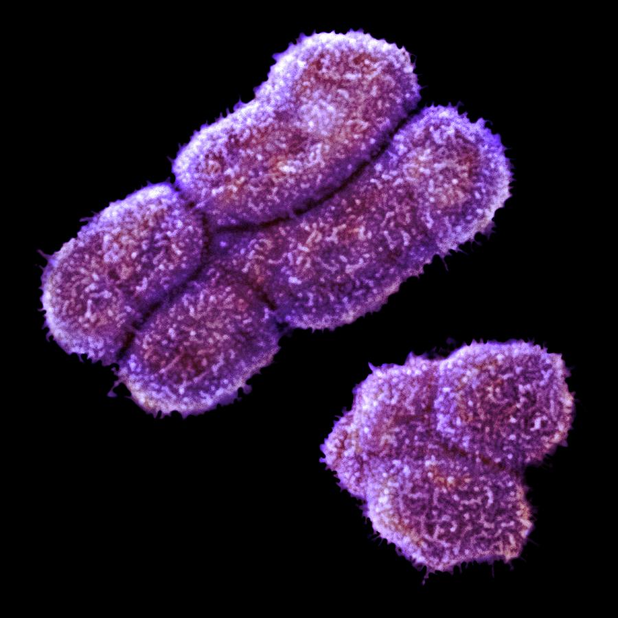 Male Human Sex Chromosomes by Power And Syred