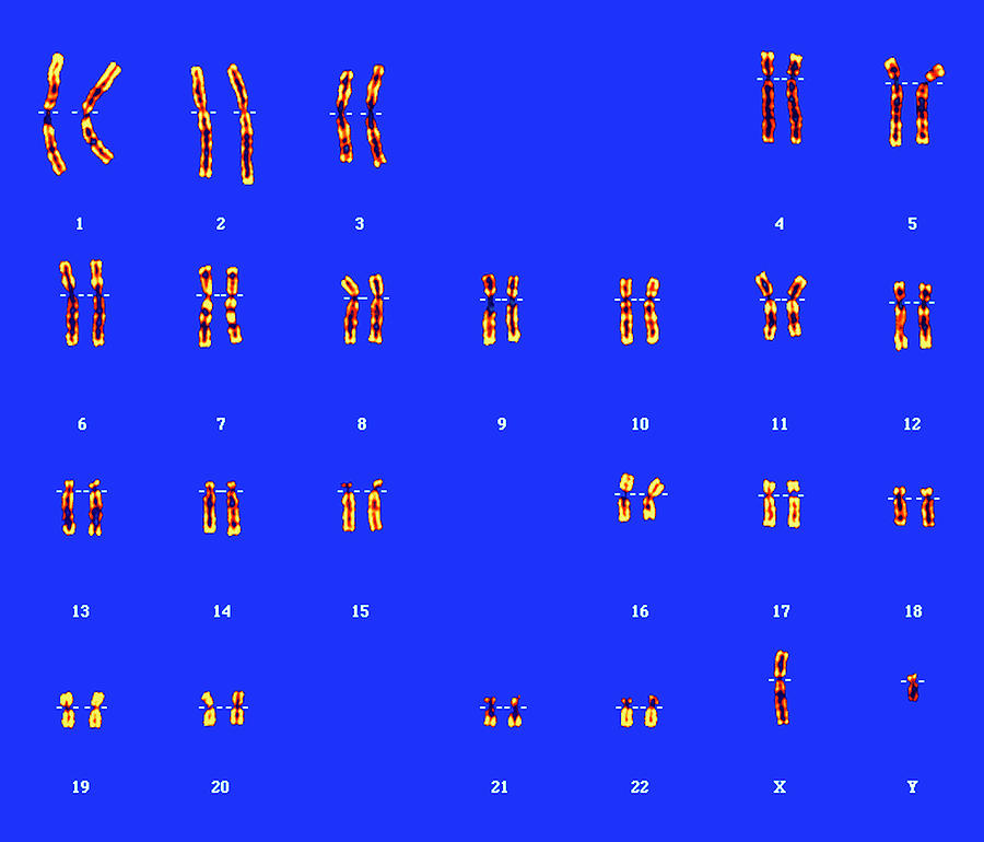 Male Karyotype Photograph by Zephyr/science Photo Library