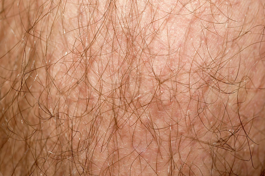 Male Leg Hair Photograph by Louise Murray - Pixels