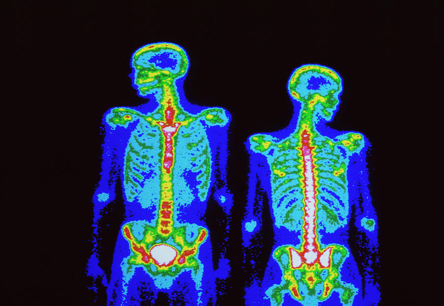 Male Skeleton Photograph by Science Photo Library Male Skeleton Photograph by Science Photo Library