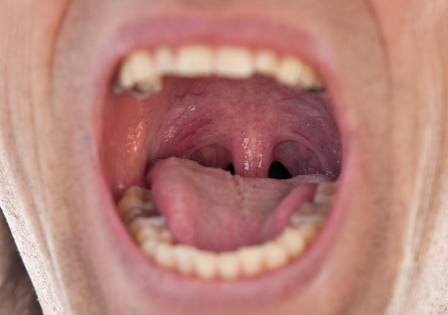 Male throat Photograph by Jan-Otto