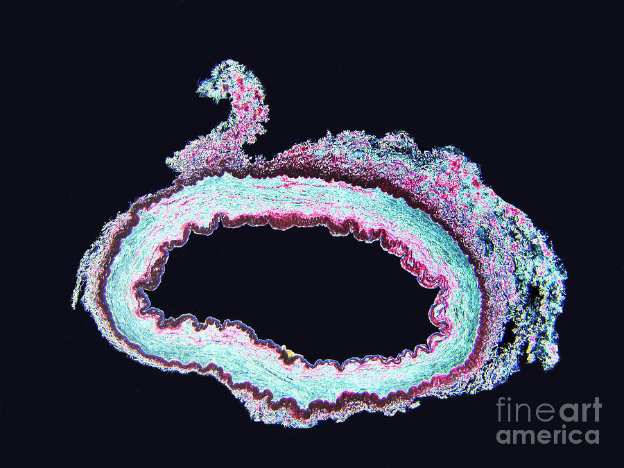 Mammalian Artery Lm Photograph by Garry DeLong