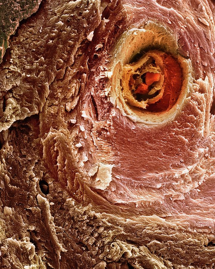 Mammalian Bone Photograph by Dennis Kunkel Microscopy/science Photo Library