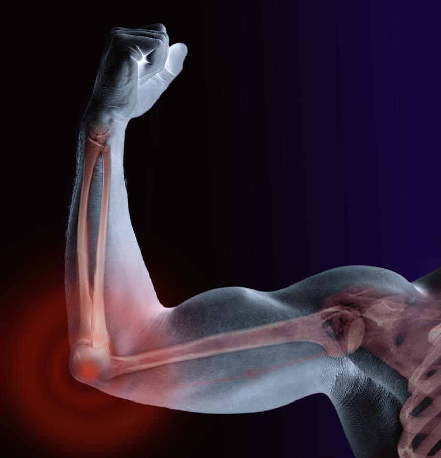 Man flexing bicep, skeleton visible, close-up (Digital Composite) Photograph by Adam Gault