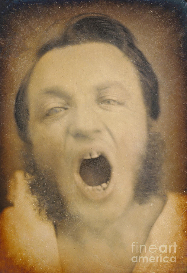 Man With Diseased Teeth And Gums, 1852 Photograph by Getty Research Institute