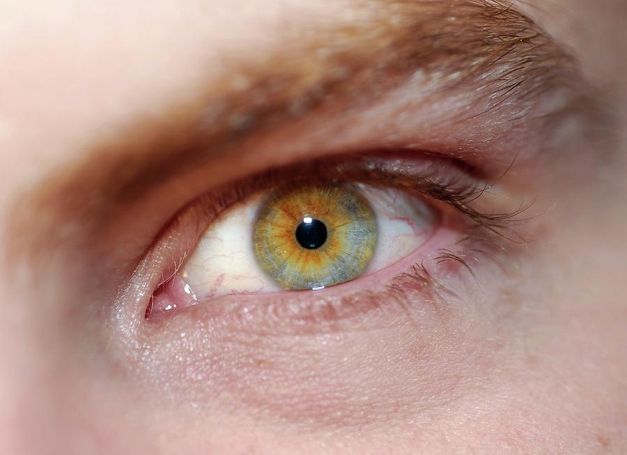 Mans Eye Photograph by Cordelia Molloy/science Photo Library