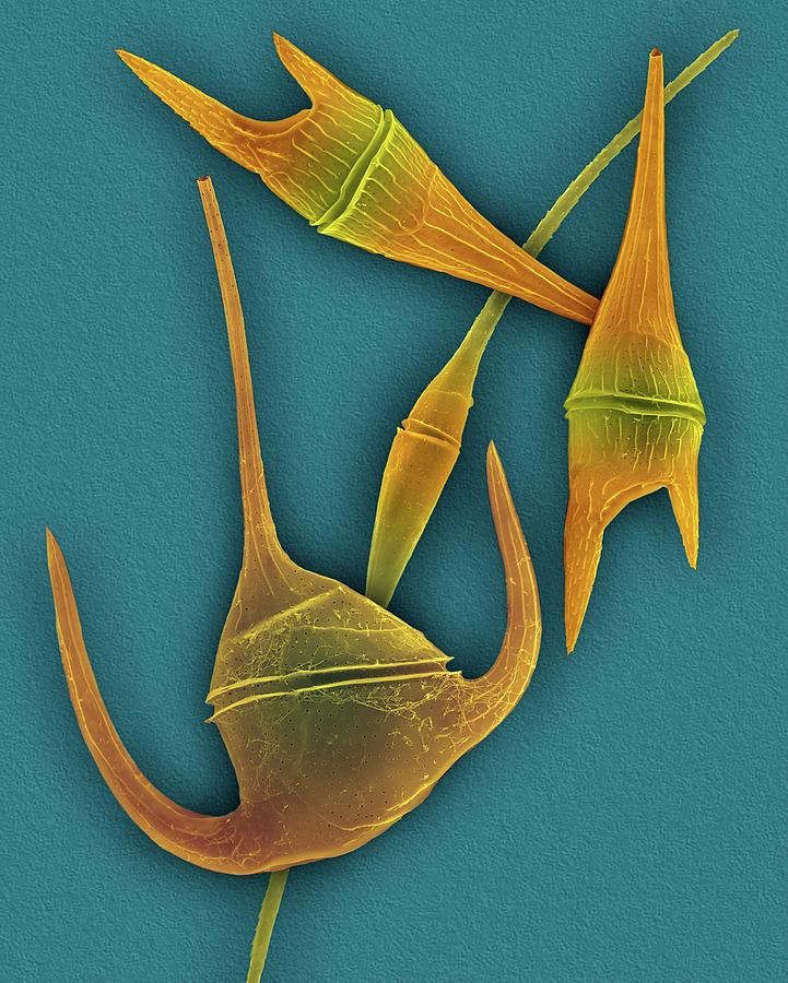 Marine Dinoflagellates (ceratium Spp.) Photograph by Dennis Kunkel Microscopy/science Photo Library