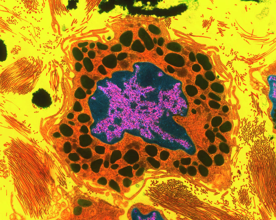 Mast Cell Photograph by Steve Gschmeissner/science Photo Library