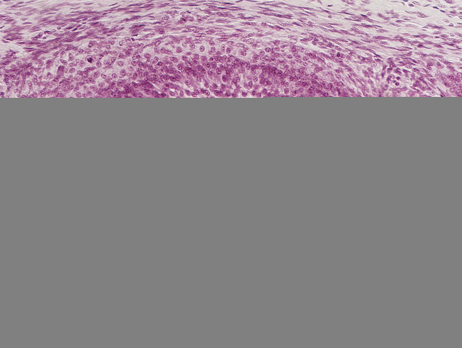 Mature Ovarian Follicle, Lm Photograph by Science Stock Photography