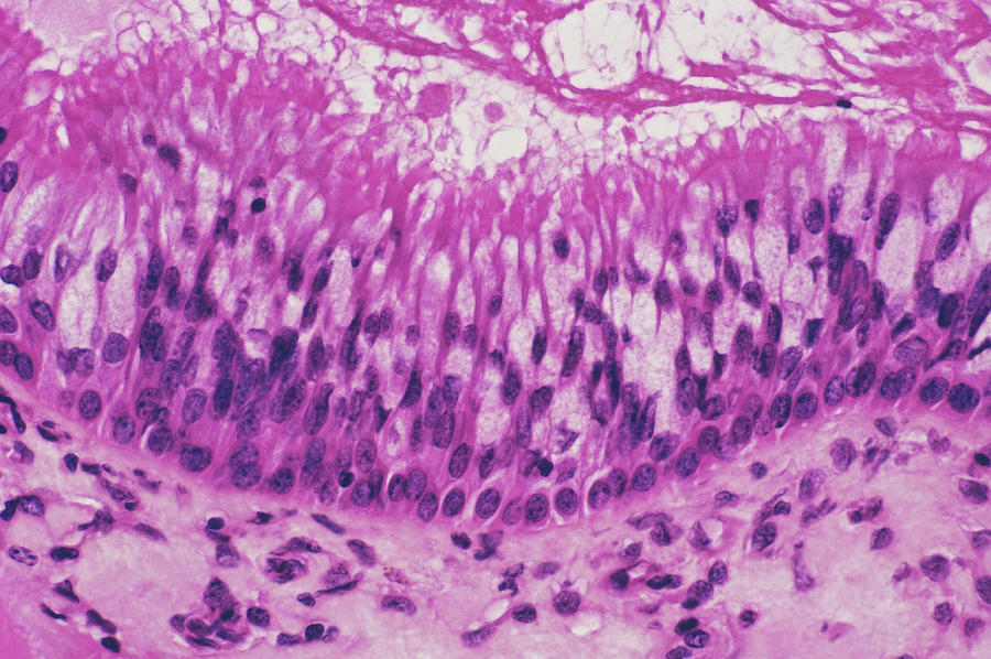 Maxillary Sinus Membrane Photograph by Cnri/science Photo Library
