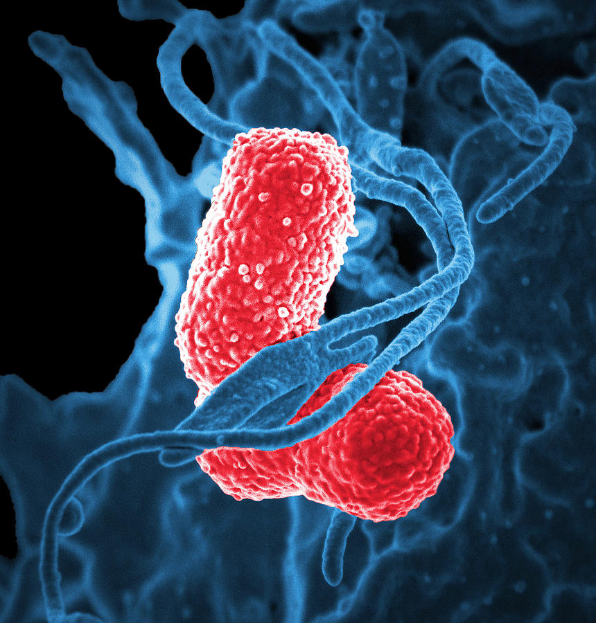 Mdr Pathogen, Klebsiella Pneumoniae, Sem Photograph by Science Source