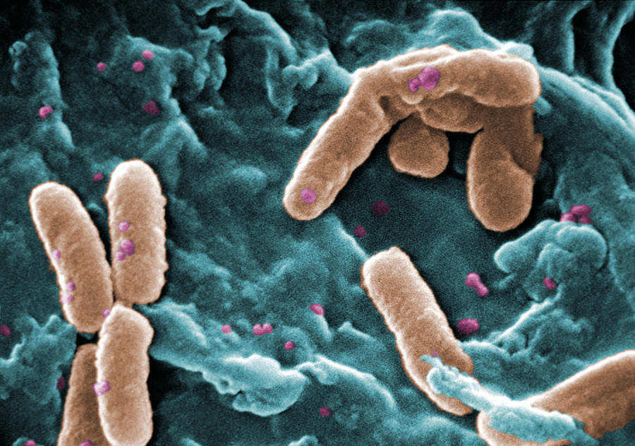 Science Photograph - Mdr Pathogen, Pseudomonas Aeruginosa by Science Source